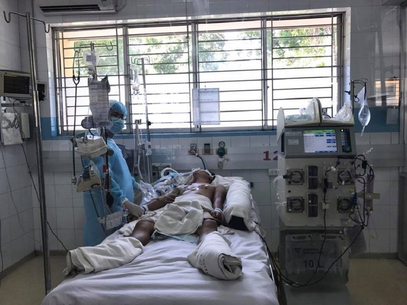Bị chó con cào nhẹ, dính luôn bệnh dại nguy kịch - ảnh 1