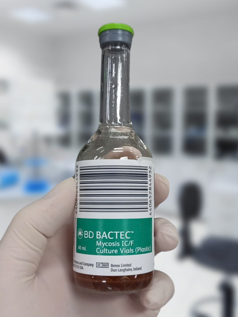 NHIỄM NẤM HISTOPLASMA 1
